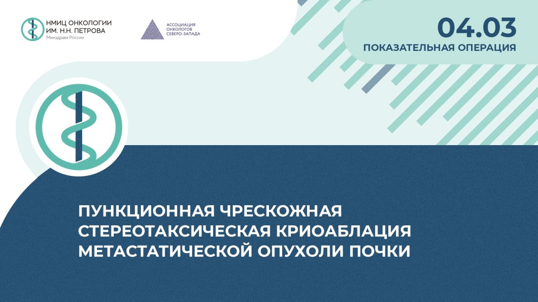 Показательная операция «Пункционная чрескожная стереотаксическая криоаблация метастатической опухоли почки»